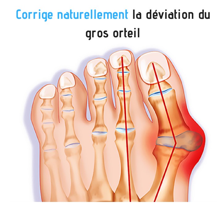 Gadgets d'Eve CORRECTB™ : Correcteur De Bunion Élastique